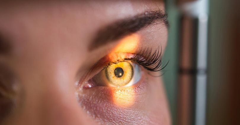 como a reabilitacao visual atua na retinose pigmentar